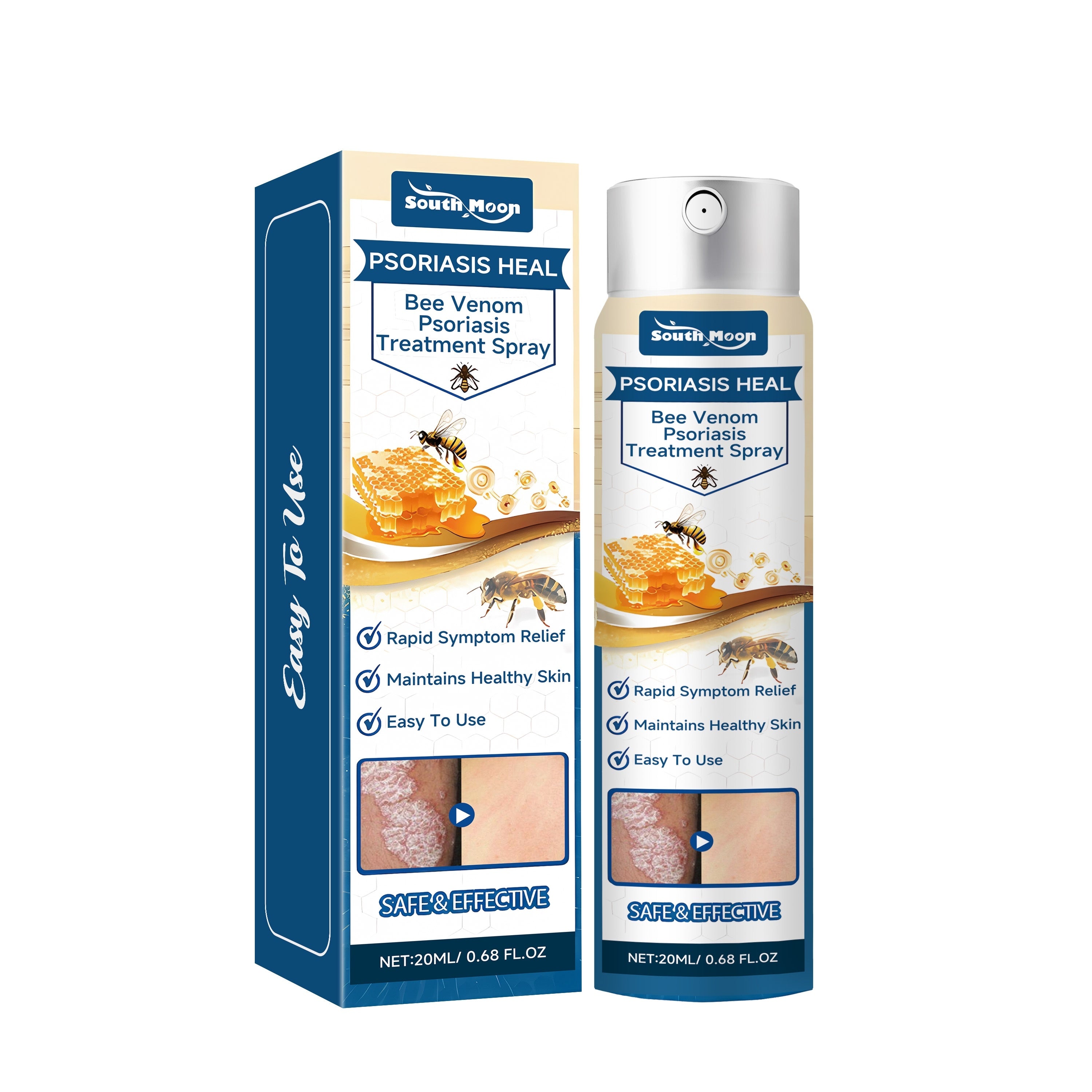 Psoriasis Relief Spray