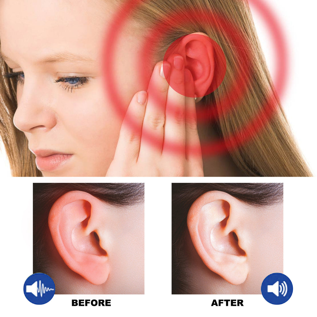 South Moon Tinnitus Relief Spray Relief